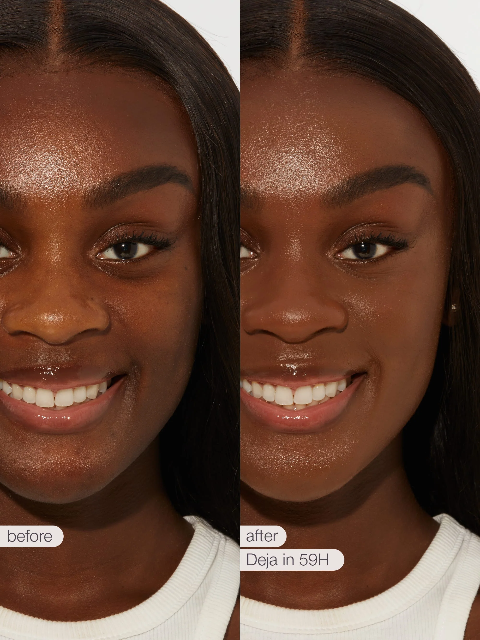 Product image 100